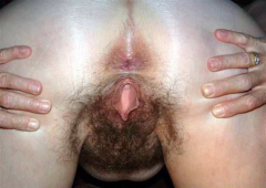 Such attractive hairy ass - N